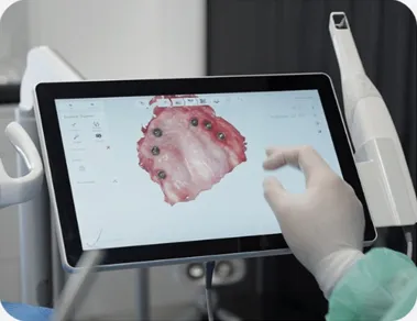 Trabajo con escáner intraoral en la Clínica Serra & Tufró
